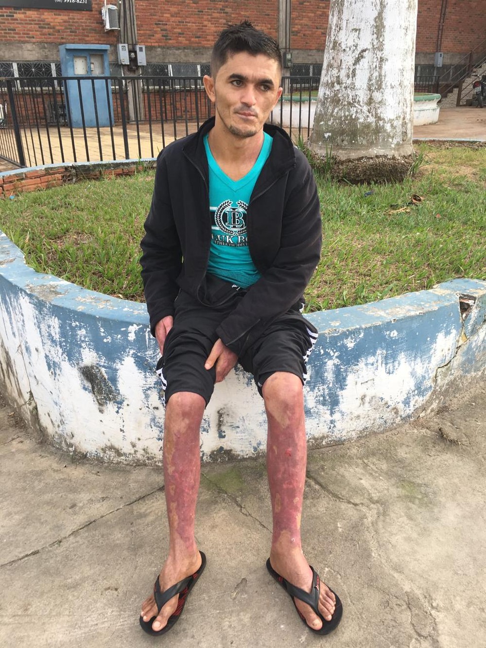 Sobrevivente de explosão de barco no AC fala de acidente: ‘só lembro que cai na água’