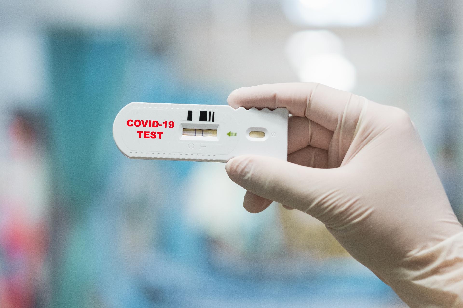 Sena Madureira já contabiliza mais de 2.300 casos da Covid-19