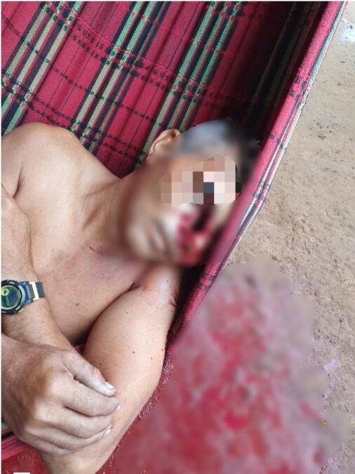Homem é assassinado com tiro no rosto na zona rural de Sena Madureira