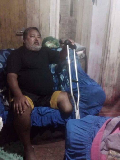 No AC, deficiente físico que perdeu a visão enfrenta dificuldades após complicações do diabetes: “Às vezes falta até alimento”