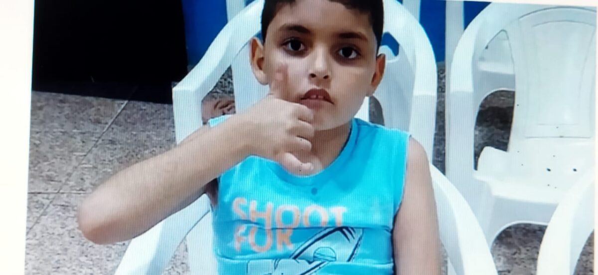 Fio de poste cai e atinge menino de 8 anos que teve queimaduras de 3º grau e precisou ser transferido do AC para GO