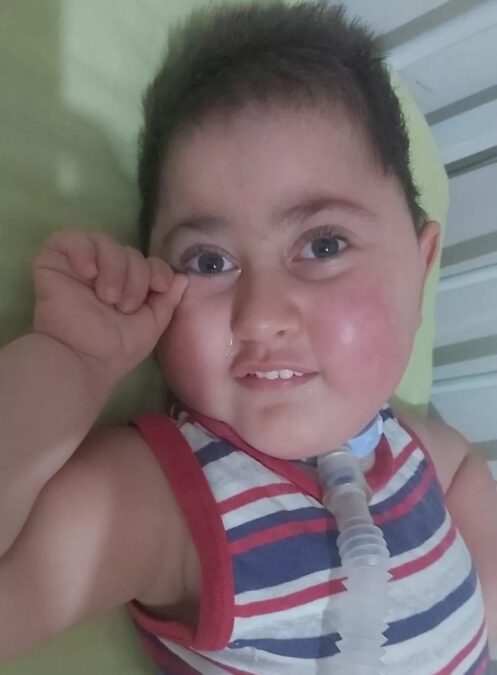 Menino com AME que chegou a morar 1 ano em hospital morre no AC: ‘era a alegria da casa’