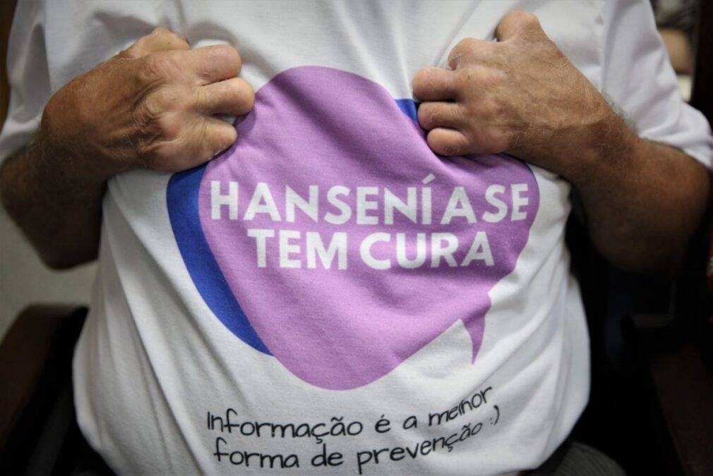 Acre participa de inquérito nacional sobre hanseníase