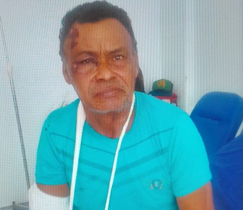 Morador de Sena Madureira fratura o braço em acidente e pede ajuda para tratamento
