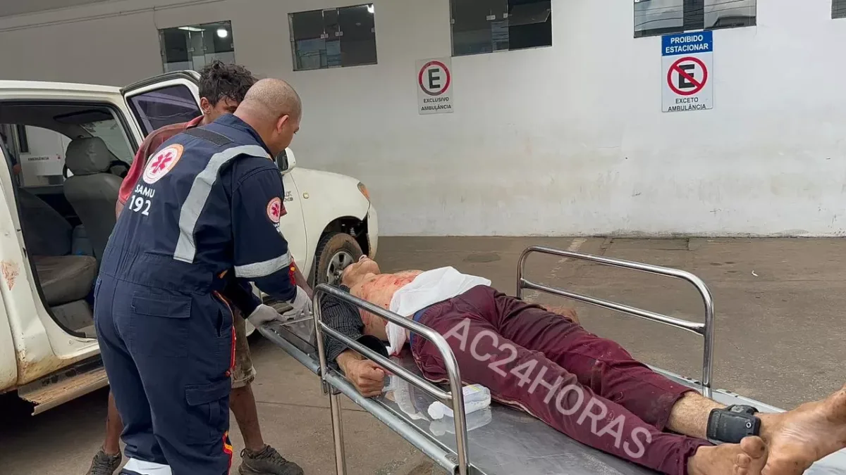 Detento monitorado por tornozeleira eletrônica morre após ser baleado durante trabalho em Rio Branco