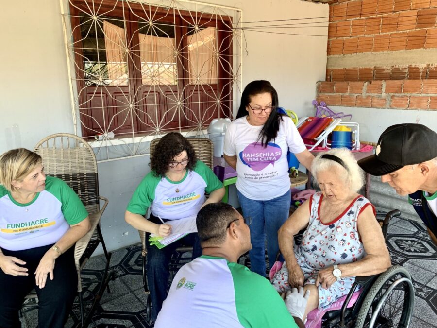 Governo do Acre atende mais de 500 pacientes em órteses e próteses em Cruzeiro do Sul