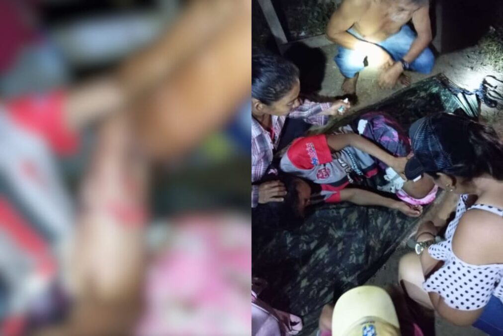 Moradora do seringal sardinha sofre ataque de jacaré às margens do rio purus