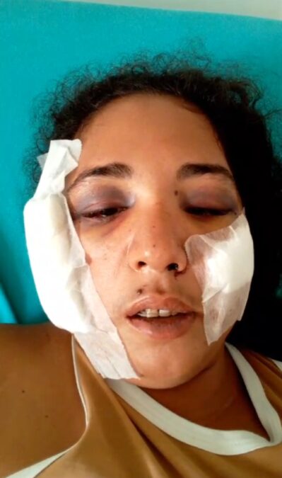 Mulher sobrevive a tiro na cabeça na estrada de Manoel Urbano: Um milagre divino