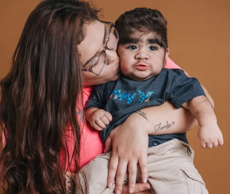 Bebê nasce com excesso de pelos e viraliza: “Feliz em saber quantas pessoas gostam dele”, diz mãe