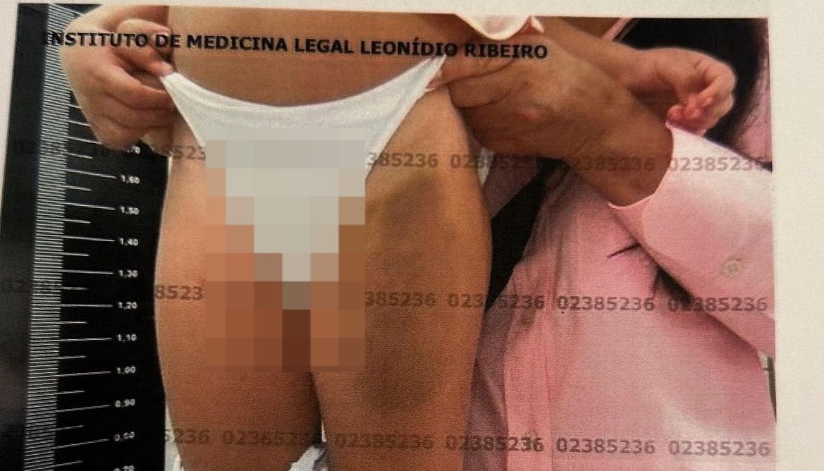 Deputada Antônia Lúcia quebra sigilo de Ação Judicial por supostas agressões a neta