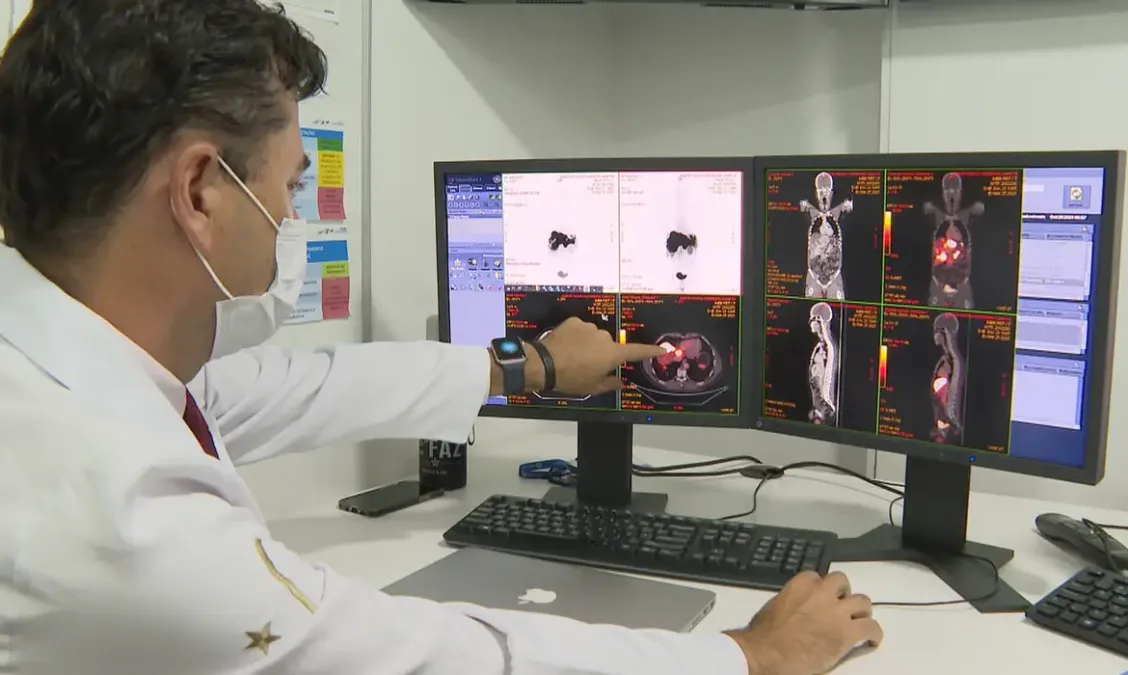 Governo amplia iniciativas para prevenção e controle do câncer no SUS e institui programa de navegação para pacientes diagnosticados