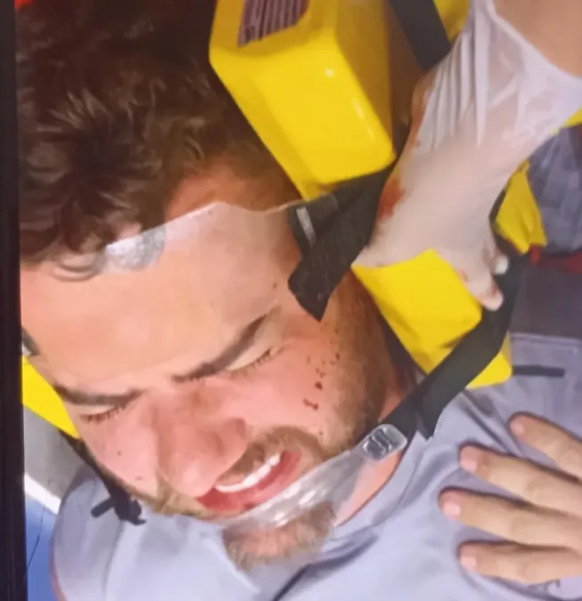 Cantor sertanejo Zé Neto sofre grave acidente de carro em Minas Gerais