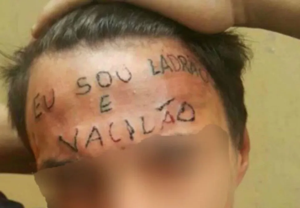 Jovem da tatuagem na testa perde direito ao regime semiaberto após fuga