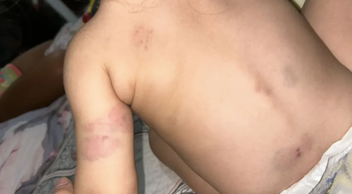 Família denuncia omissão de socorro após bebê ser agredido por outras crianças em creche na Rocinha, Rio de Janeiro