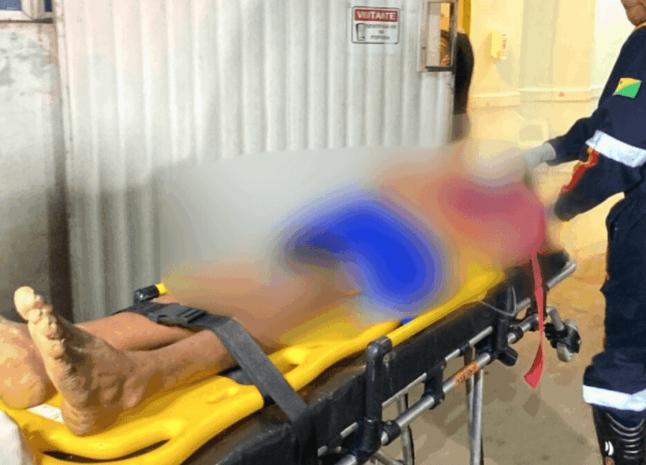Adolescente sofre grave ferimento após acidente com rolete em Sena Madureira