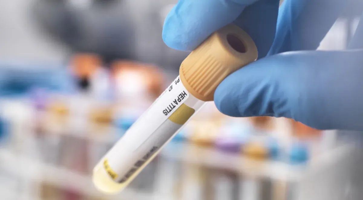 Julho Amarelo no Acre: mais de 4 mil casos de hepatites virais registrados em 10 anos