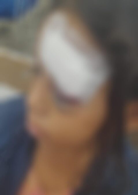 Briga de casal indígena em Sena Madureira deixa criança ferida no olho, populares agridem a jovem