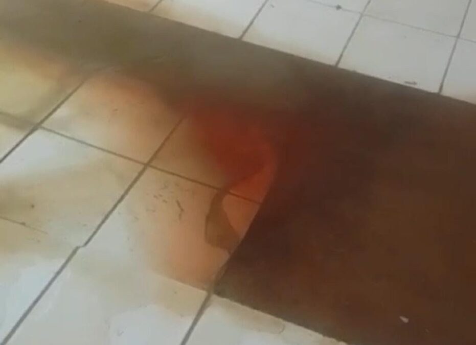 Vídeo mostra água com sangue na lavanderia do Hospital João Câncio, e servidores ameaçam paralisação