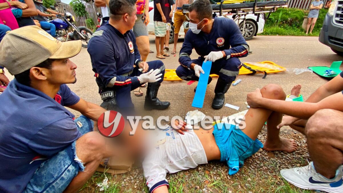 Adolescente rouba moto do cunhado, provoca acidente e vai parar no PS com a perna, mão e costelas quebradas em Rio Branco