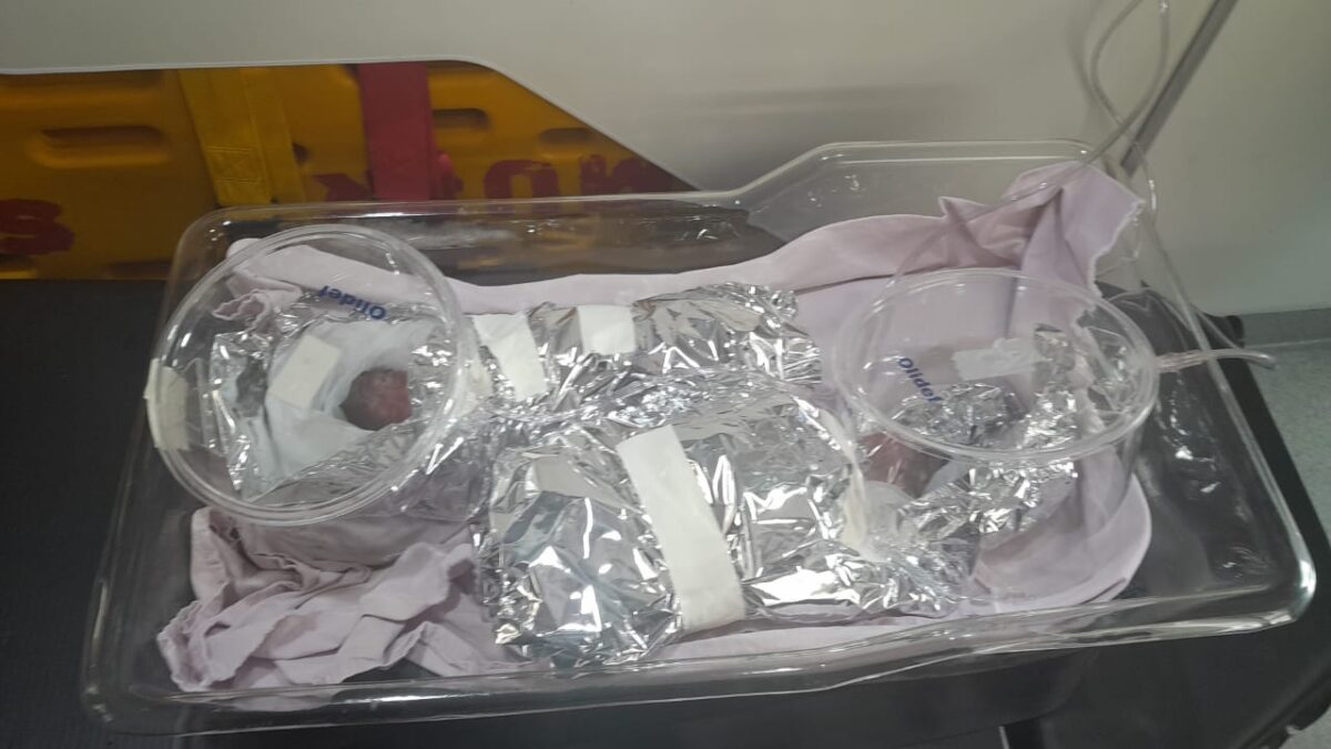 Gêmeas indígenas prematuras socorridas em Manoel Urbano não resistem e morrem em Rio Branco