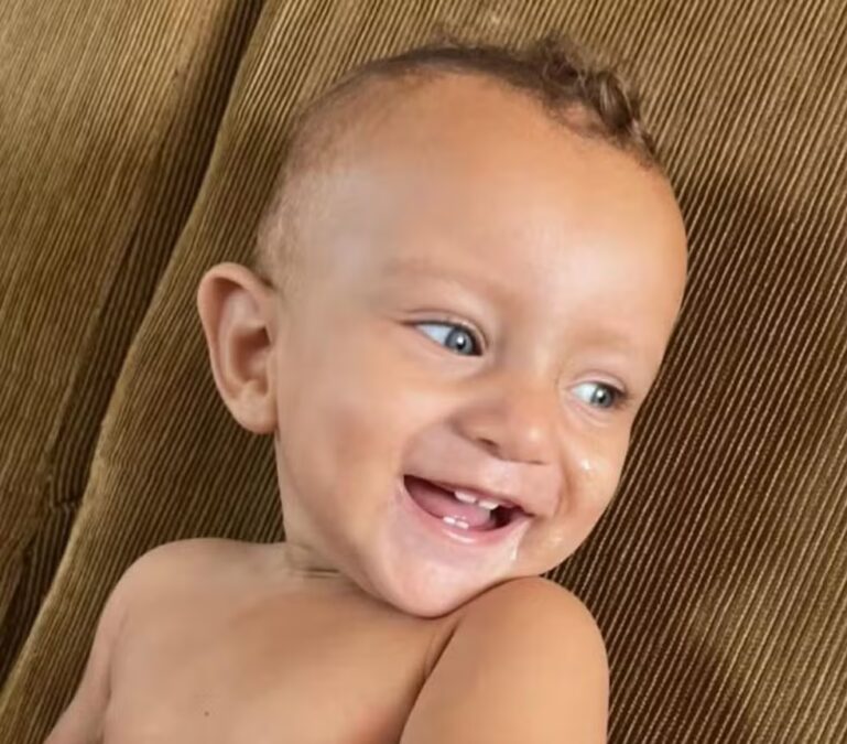 Bebê morre após queimaduras graves em acidente com panela de brigadeiro no Acre