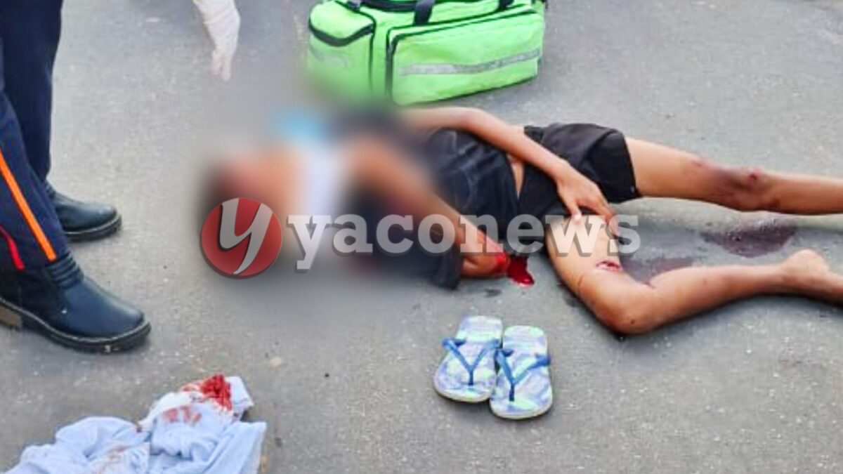 Criança de 12 anos fica gravemente ferida após atropelamento no bairro João Alves, em Cruzeiro do Sul