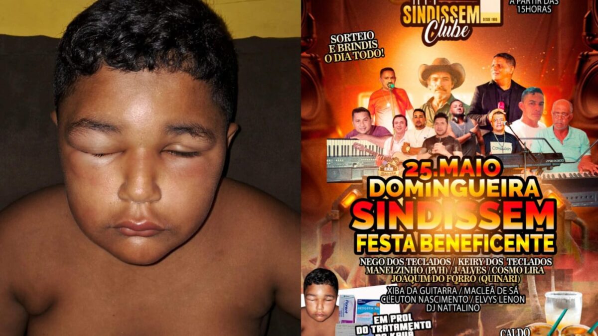 Show solidário neste domingo (25) em Sena Madureira busca arrecadar fundos para tratamento de Kauã
