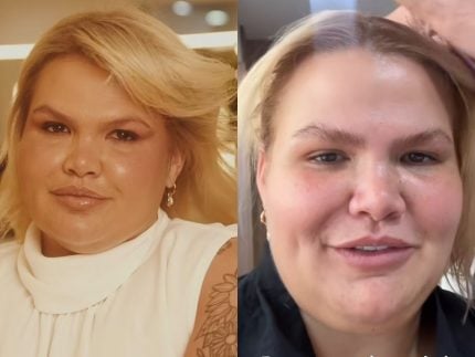 thais-carla-relata-efeito-colateral-apos-bariatrica-e-tratamento:-“se-agravou”