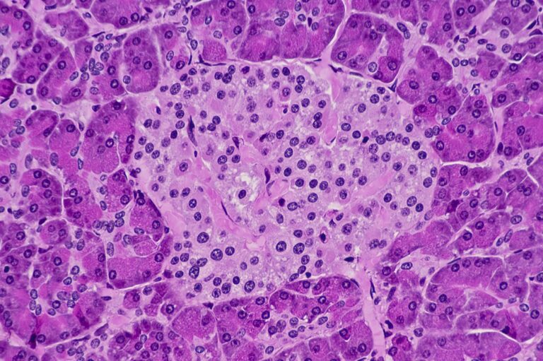 estresse-metabolico-pode-aumentar-a-producao-de-insulina-no-sangue