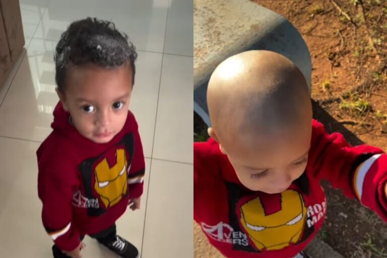 video:-crianca-usa-creme-depilatorio-na-cabeca-e-perde-o-cabelo
