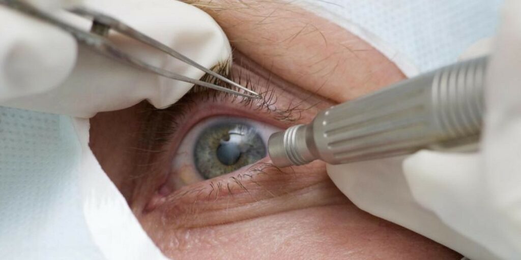 cirurgia-que-altera-cor-do-olho-tem-uso-restrito-para-pessoas-cegas