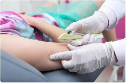 sus-passara-a-oferecer-implante-anticoncepcional-a-partir-do-segundo-semestre