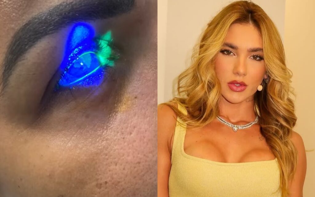 mulher-afirma-ter-ficado-cega-apos-usar-produto-de-virginia-fonseca