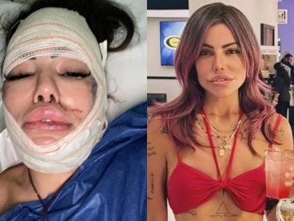 sem-medo-do-bisturi,-liziane-gutierrez-vai-encarar-nova-cirurgia-apos-mais-de-20-plasticas