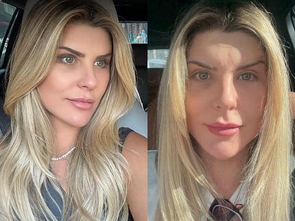 iris-stefanelli-mostra-rosto-apos-plastica:-“um-dos-maiores-investimentos-que-ja-fiz”
