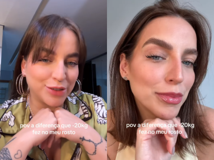 bruna-unzueta-choca-seguidores-com-antes-e-depois-do-rosto-apos-emagrecer-20-kg