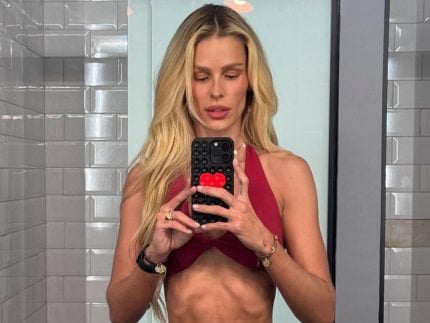 yasmin-brunet-segue-protocolo-sem-cirurgia-para-tratar-lipedema;-medico-explica-tratamento