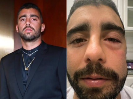 especialista-faz-alerta-apos-caso-de-pedro-scooby-vir-a-tona:-“nunca-ignore”