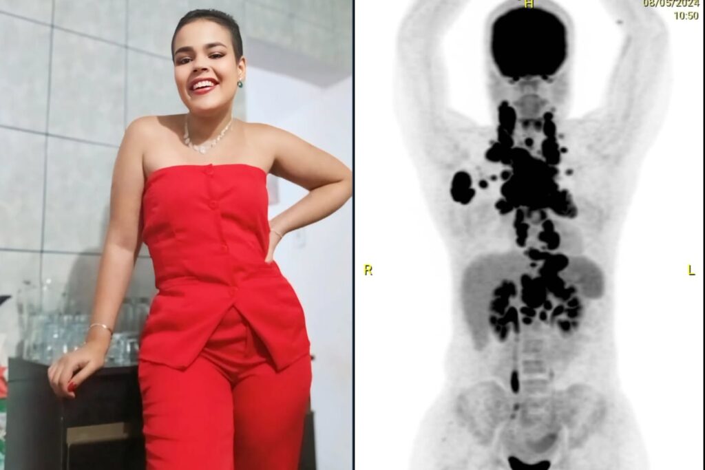 jovem-conta-sinais-que-ignorou-de-cancer-que-a-“esmagava-por-dentro”