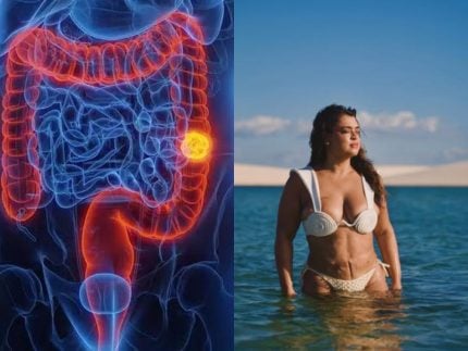 o-alerta-de-preta-gil:-sintomas-do-cancer-que-ela-enfrentou-e-que-voce-deve-conhecer