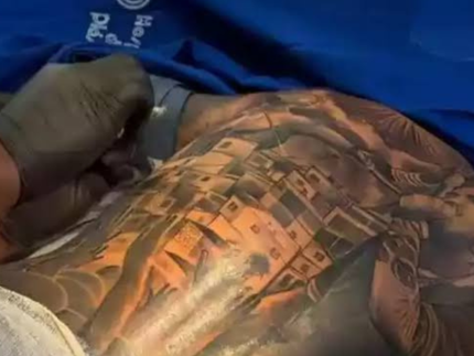 tatuagem-com-anestesia:-especialista-avalia-riscos-apos-proibicao-do-cfm