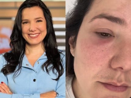 jornalista-da-record-volta-a-ser-internada-apos-infeccao-grave-no-rosto:-“susto”