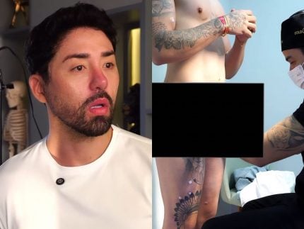 rico-melquiades-faz-harmonizacao-peniana,-como-adiantou-o-portal-leodias