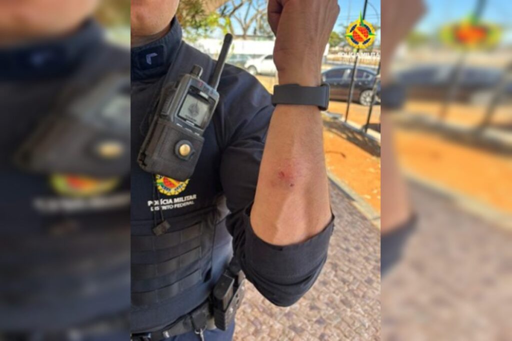 df:-homem-ataca-e-morde-pm-ao-descumprir-medida-protetiva