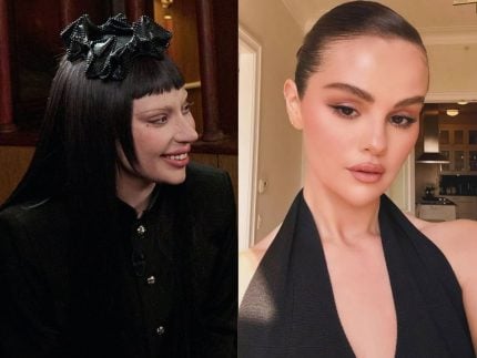 lupus,-doenca-de-famosas-como-selena-gomez-e-lady-gaga,-pode-causar-problemas-na-visao