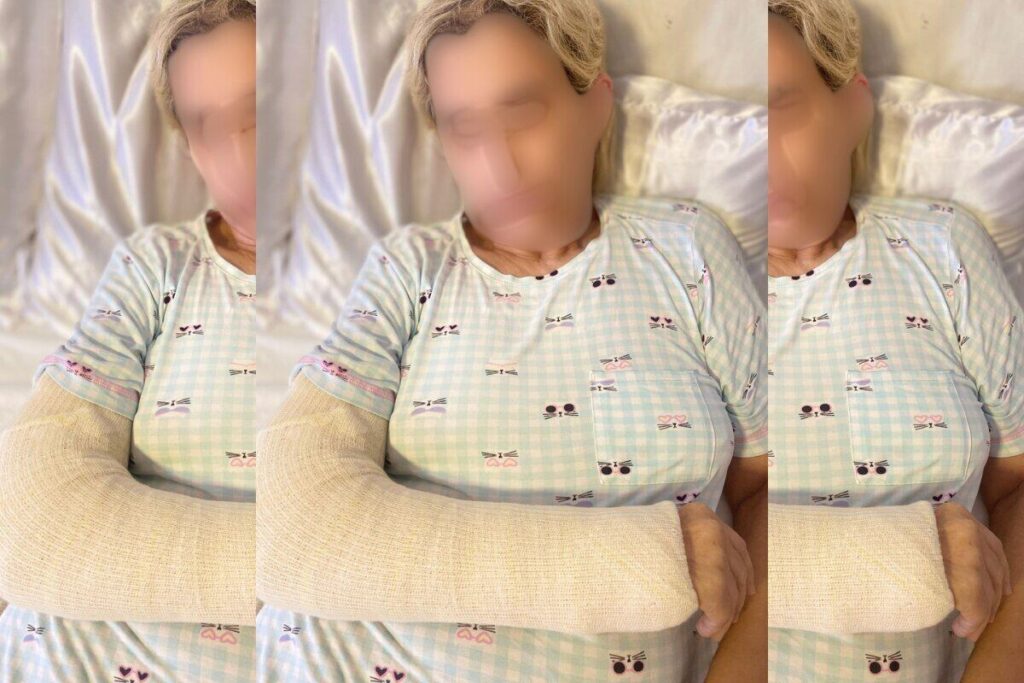 ibirapuera:-aposentada-“atropelada”-por-corredor-quebra-bacia e braco