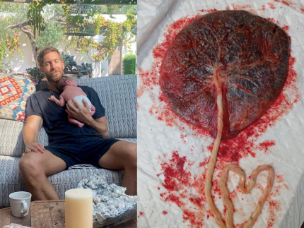 comer-placenta-faz-bem-para-saude-da-mae?-especialistas-avaliam-metodo-aderido-por-famosos