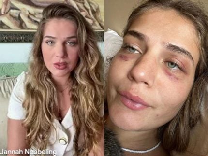 ex-de-jorge-baez-denuncia-violencia-psicologica-e-fisica:-“ele-me-sufocou”;-ex-jogador-e-procurado