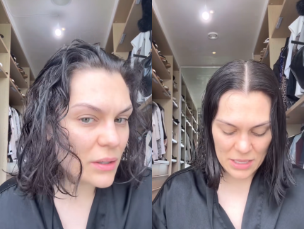 jessie-j-revela-queda-de-cabelo-apos-mastectomia-e-fala-sobre-recuperacao-do-cancer