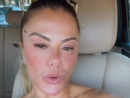 poliana-rocha-e-diagnosticada-com-conjuntivite-quimica:-“nao-e-contagiosa”